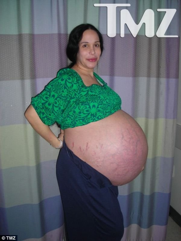 Жесть дня. Беременная восьмерней (5 фото)