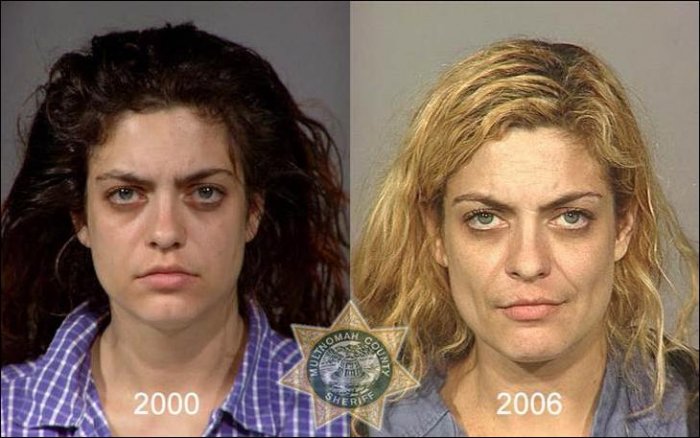 Как наркотики меняют людей (21 фото)