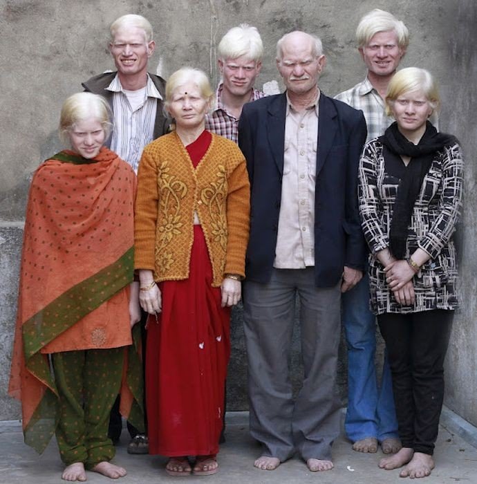 Семья альбиносов (4 фото)