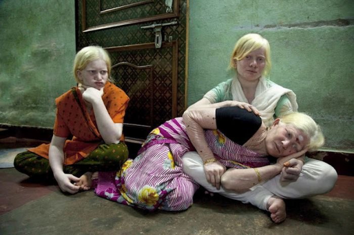 Семья альбиносов (4 фото)