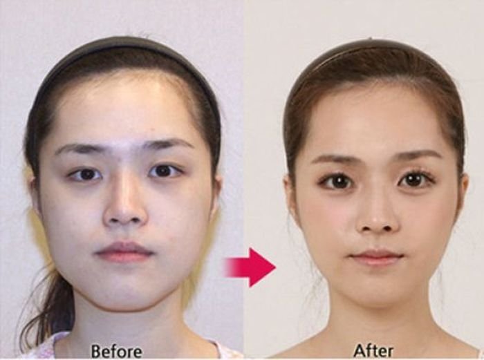 До и после пластического хирурга (61 фото)