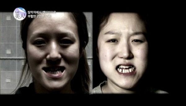 Близняшки из Кореи до и после пластических операций (11 фото)