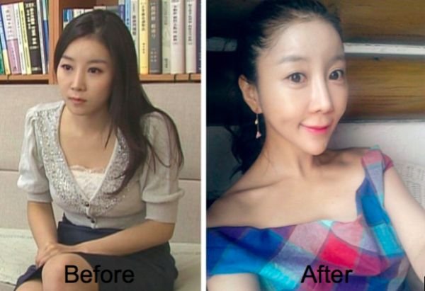 Корейская телеведущая до и после пластической операции (6 фото)