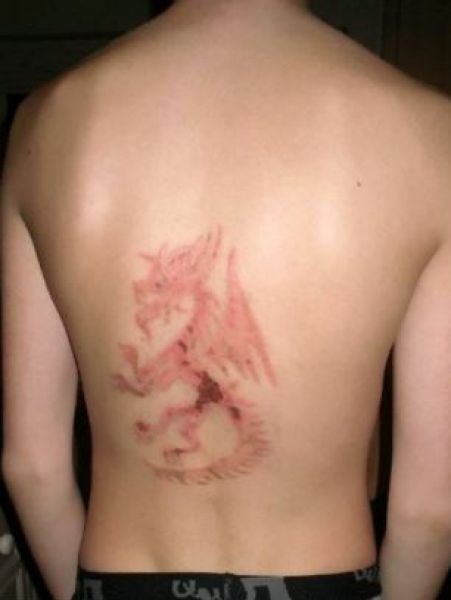 Последствия татуировки хной (7 фото)