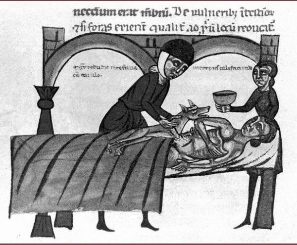 Медицина в средние века (16 фото)