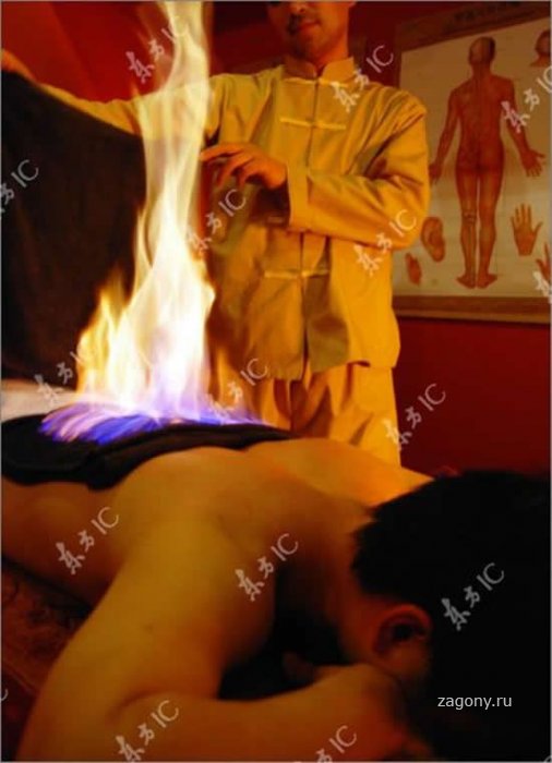 Огненный массаж (5 фото)