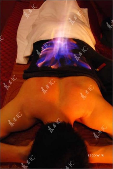 Огненный массаж (5 фото)