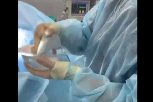 Пластический хирург шутит о новых силиконовых имплантах