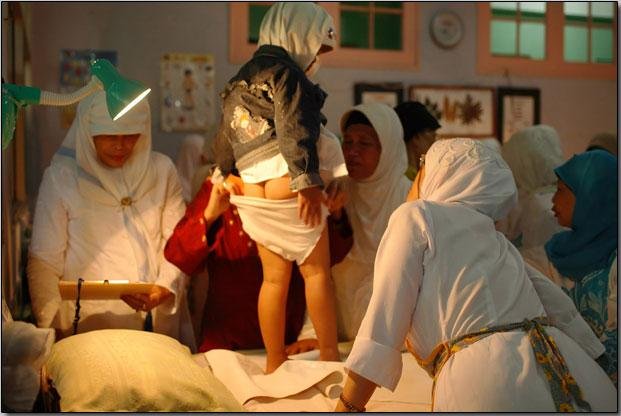 Женское обрезание (15 фото)
