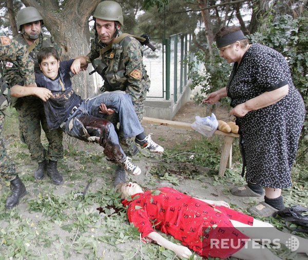 Разоблачение грузинских снимков для западной прессы (8 фото)