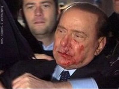 Что на самом деле случилось с Берлускони (5 фото)