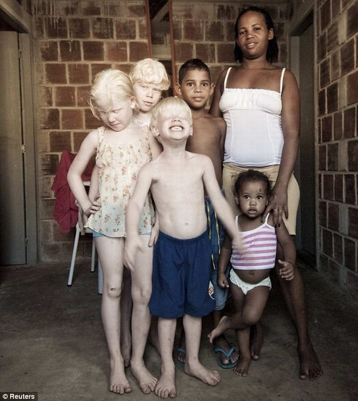Три альбиноса в семье (4 фото)