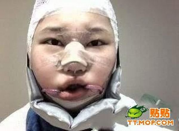 Пластическая операция на лице (9 фото)