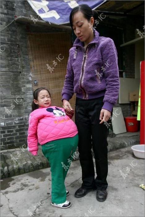Девочка с огромным животом (19 фото)