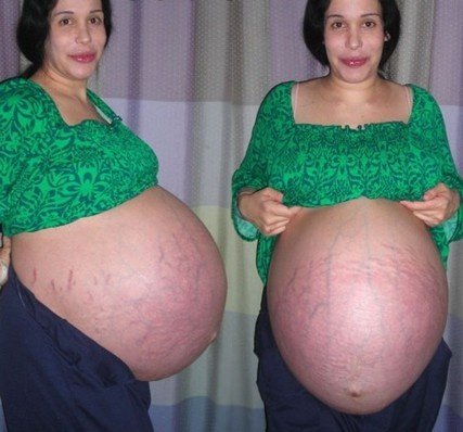 Надя Сулейман - женщина, родившая 8 близнецов (5 фото)