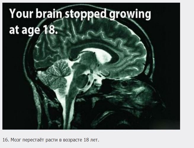 Факты о мозге (18 фото)