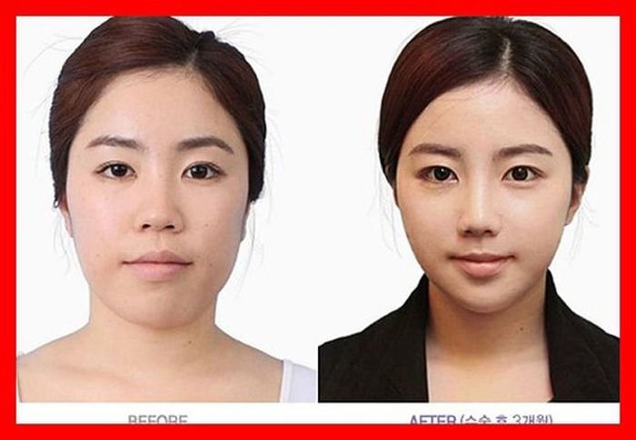 До и после пластического хирурга (61 фото)