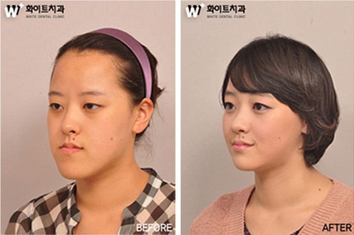 До и после посещения пластического хирурга (31 фото)