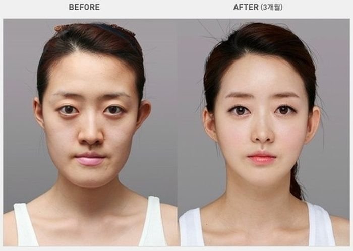До и после посещения пластического хирурга (31 фото)