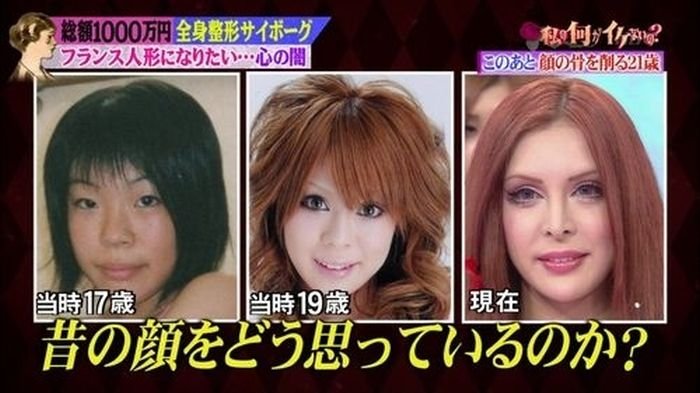 Девушка из Японии до и после пластических операций (15 фото)