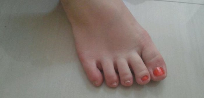 Как быстро накрасить ногти на ногах (2 фото)