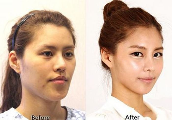 До и после пластических операций (10 фото)