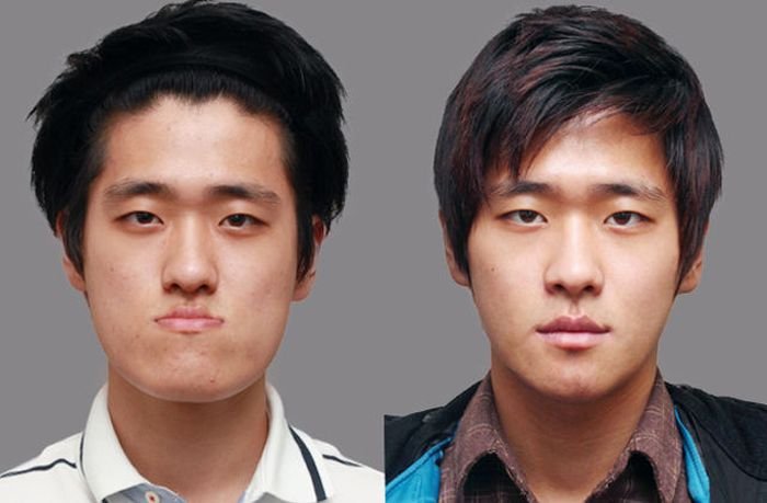 До и после пластических операций (10 фото)