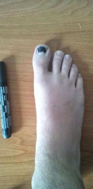 Решение проблемы дырявого носка (3 фото)