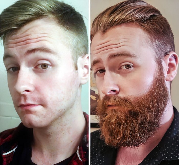 Люди, отрастившие себе бороду