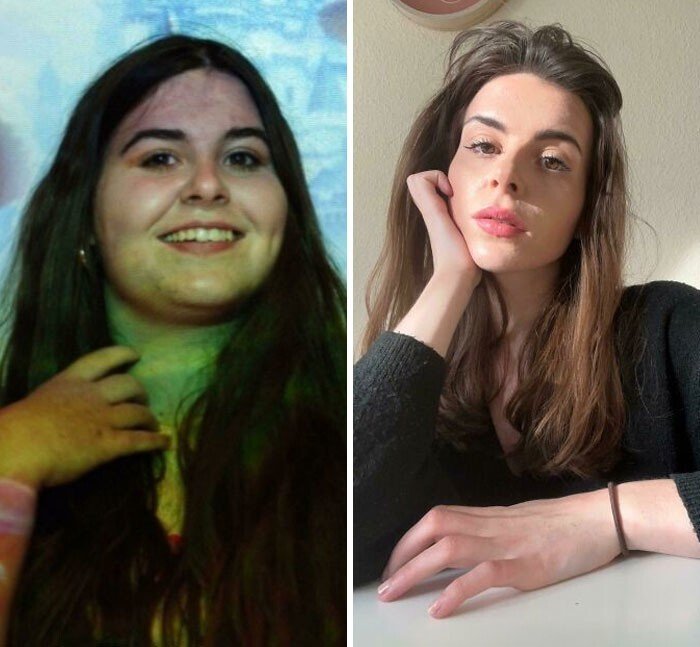 До и после похудения (25 фото)
