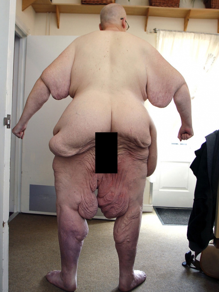 Мужчина похудел на 300 килограмм (4 фото)